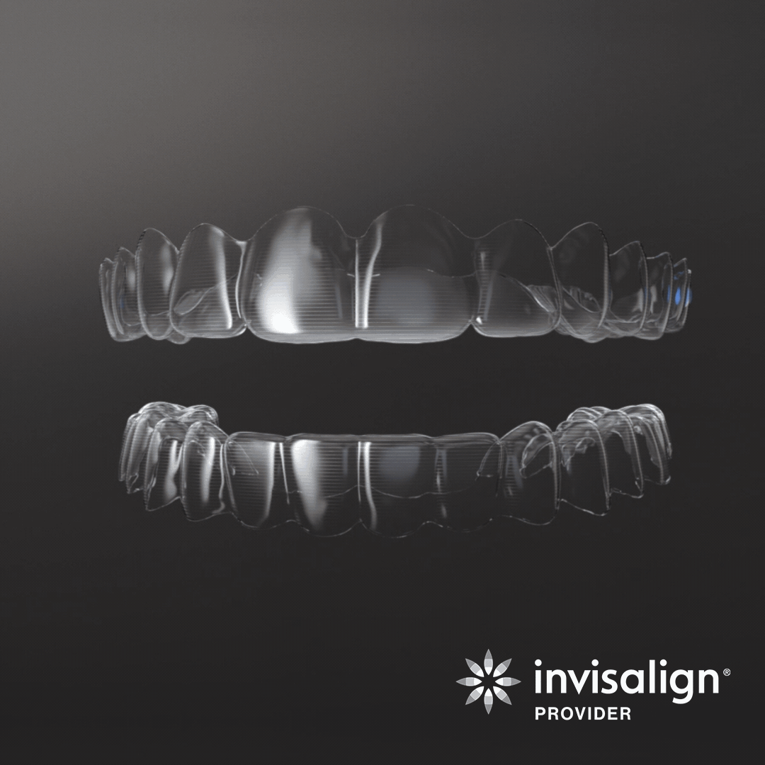 Customised Invisalign Aligners
